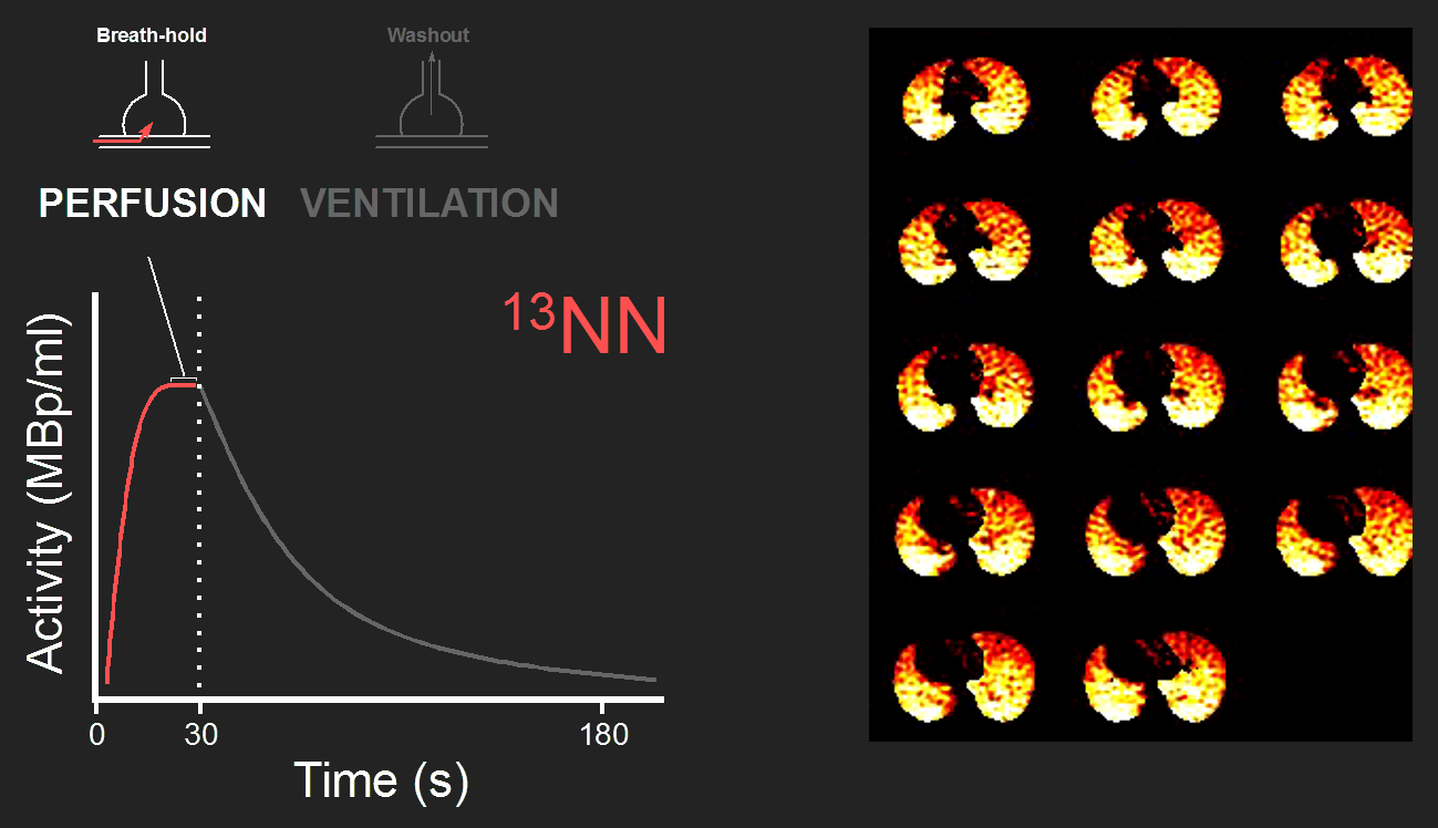 13NN tracer kinetics, perfusion, and PET example