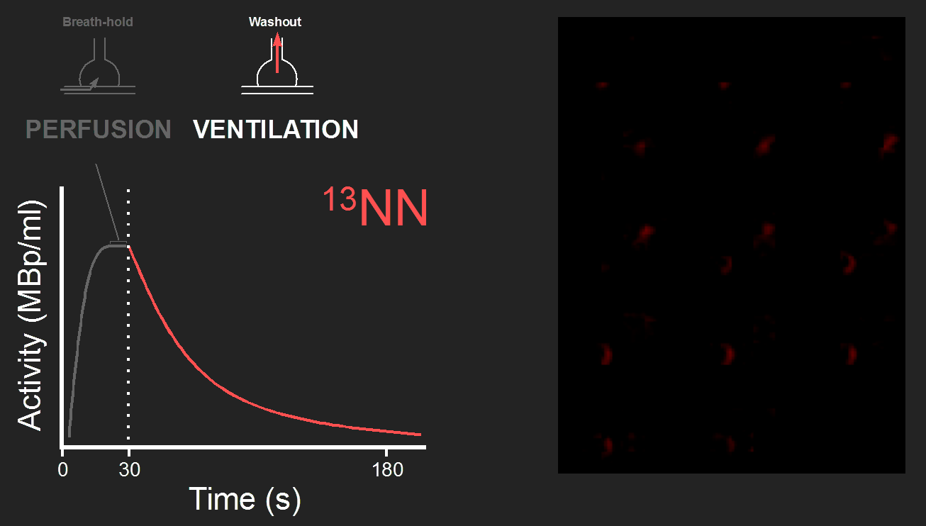 13NN tracer kinetics, ventiation, and PET example