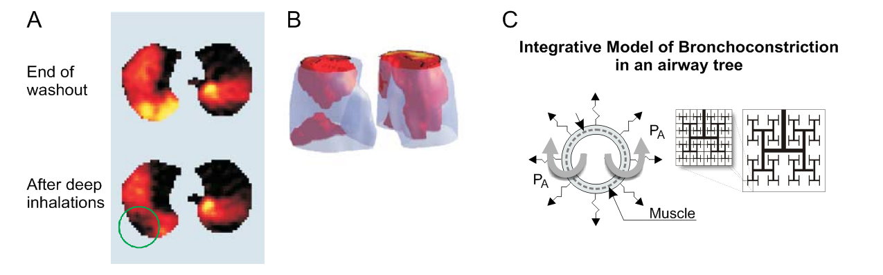 Overview: VDefs and bronchoconstriction