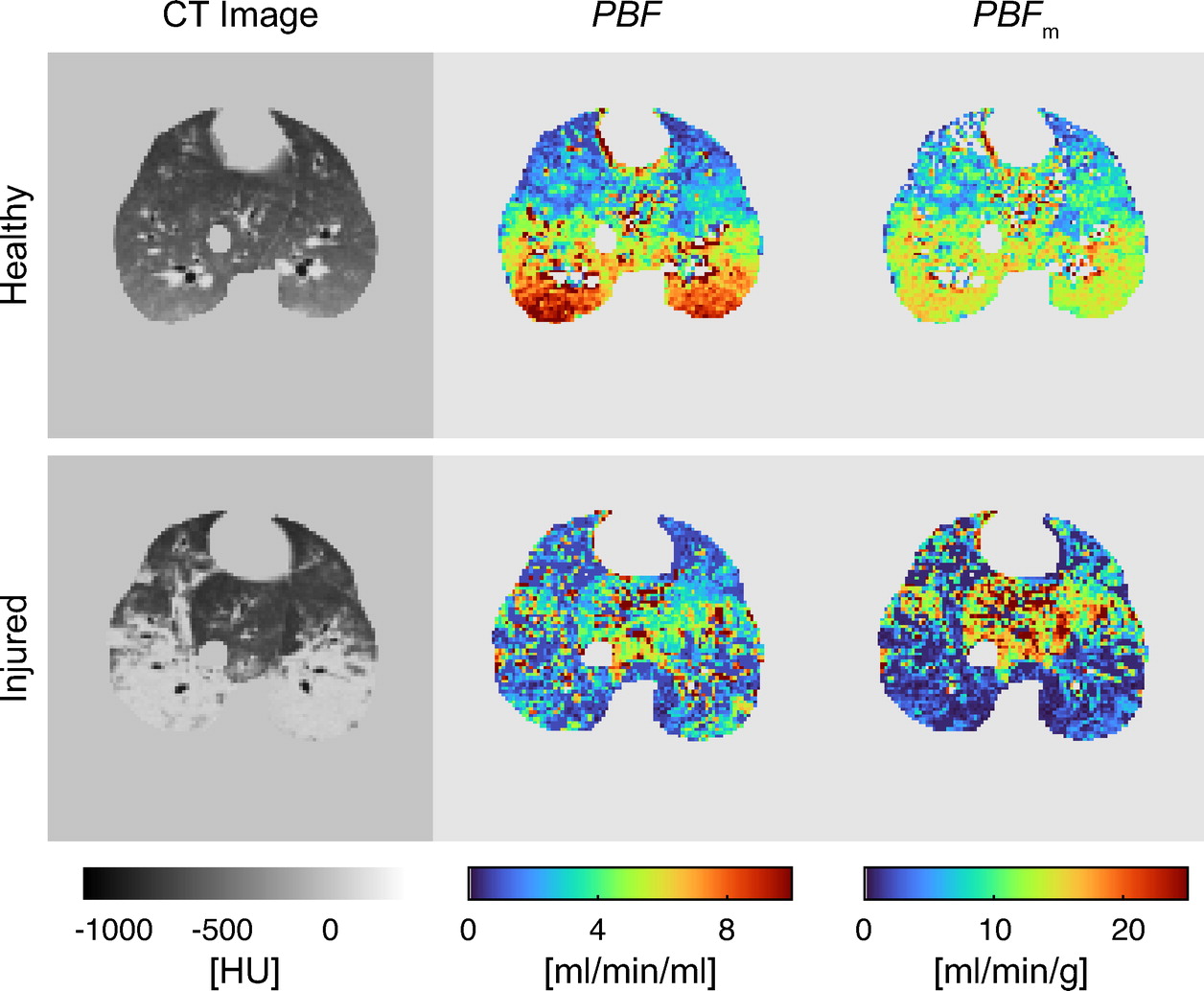 summary image: figure excerpt showing the discrimination between PAH and controls, and panel with 3D renderings of pulmonary perfusion