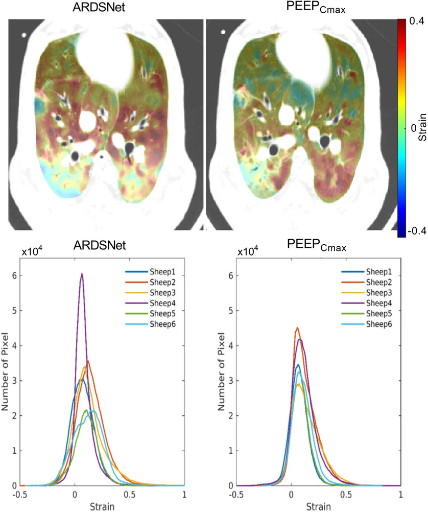 summary image: figure excerpt showing the discrimination between PAH and controls, and panel with 3D renderings of pulmonary perfusion
